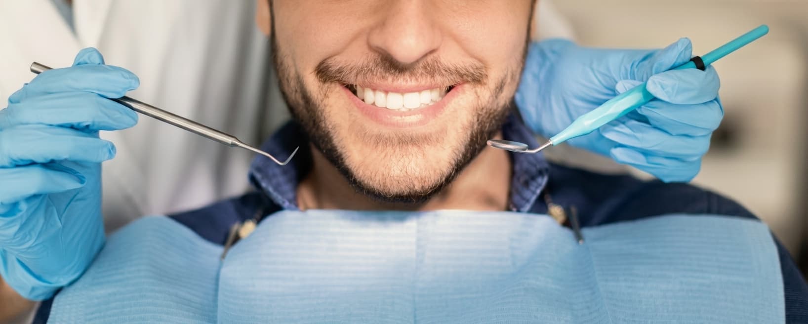 Bleaching: Ablauf, Wirkung und Haltbarkeit im Überblick